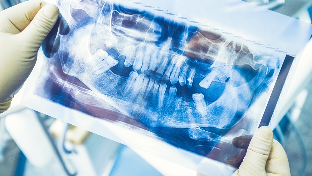 Dental professional holding a panoramic X-ray, highlighting advanced imaging used for diagnosing oral health issues and planning treatments